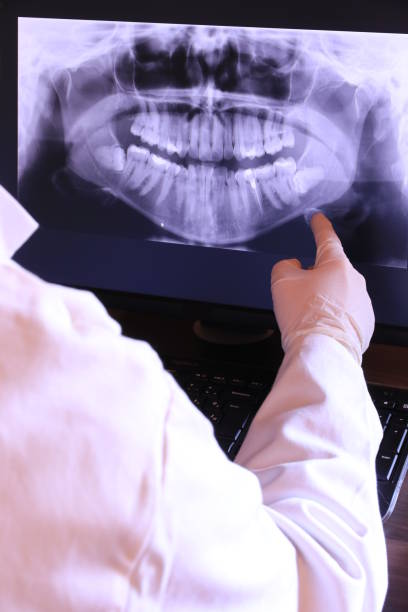 Best Emergency Treatment for Dental Infections or Abscesses in Clifton Gardens, NY