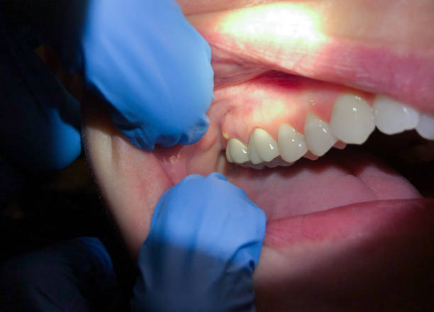 Best Pediatric Emergency Dentist in Clifton Gardens, NY