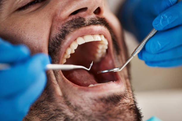 Best Emergency TMJ Treatment in Clifton Gardens, NY